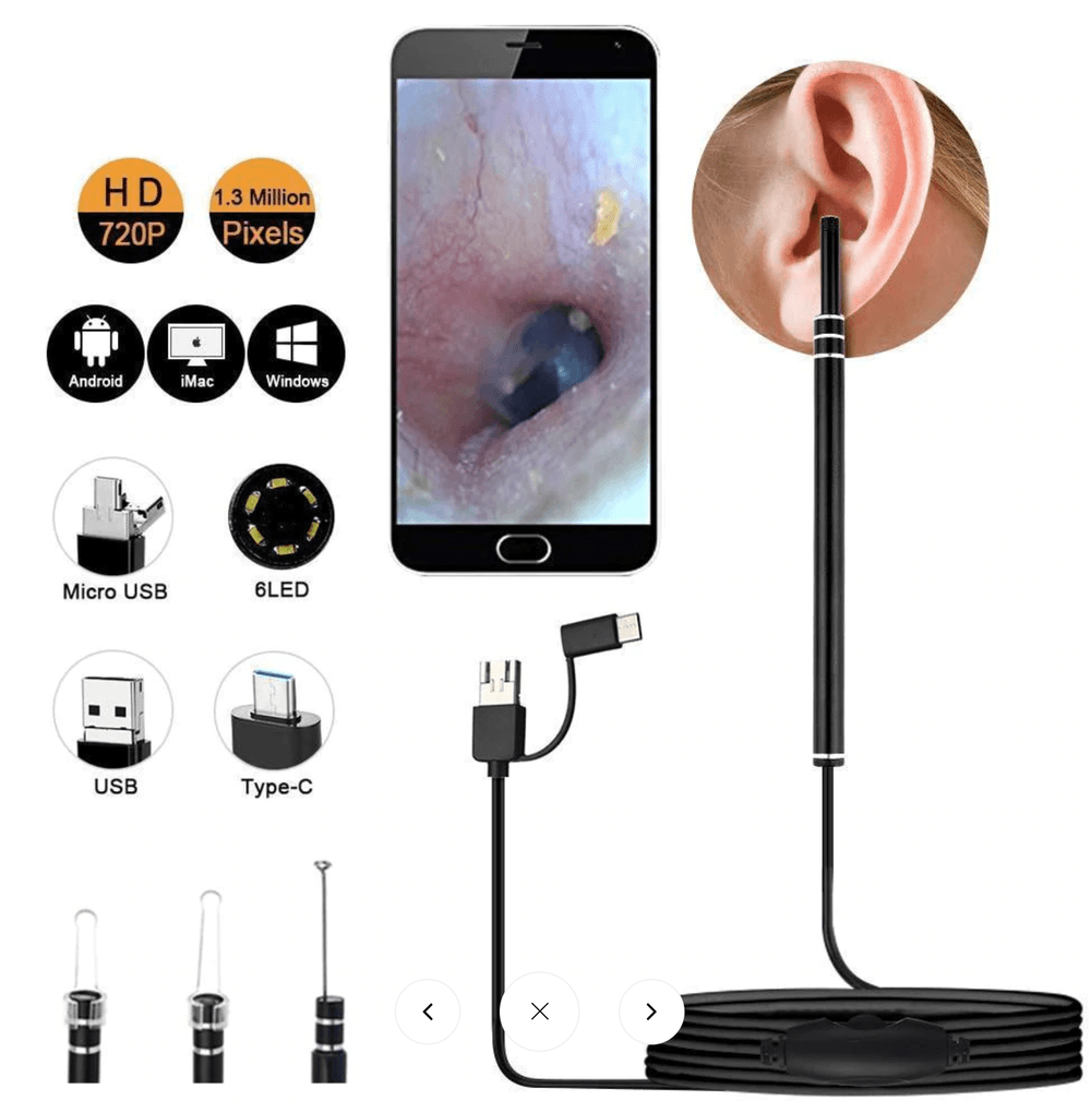 LED Ear Endoscope HD Otoscope Ear Wax Cleaning Camera – Gadfever